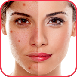 دانلود Blemishes Remover You Makeup