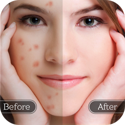 دانلود Face Blemish Remover - Smooth 