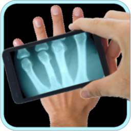 ایکس ری تایمز 3