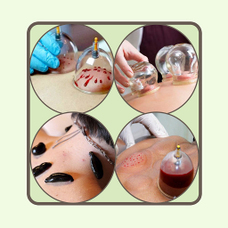 دانلود آموزش حجامت خانگی