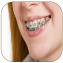 Braces Photo Editor - Braces For Your Teeth