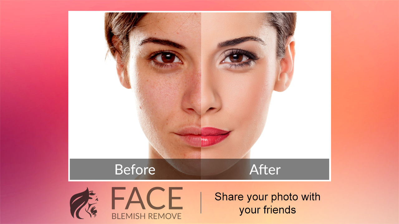 اسکرین شات 2 برنامه Blemishes Remover You Makeup