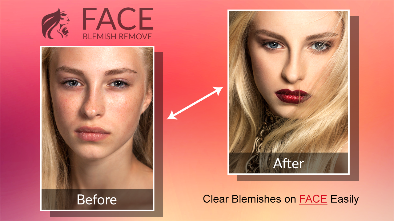 اسکرین شات 5 برنامه Blemishes Remover You Makeup
