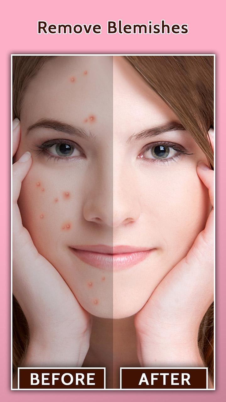 اسکرین شات 1 برنامه Face Blemish Remover - Smooth