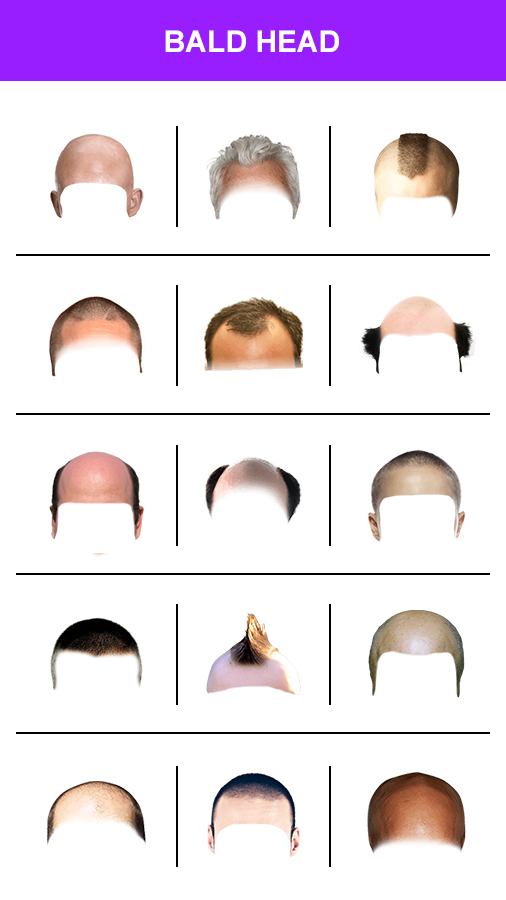 اسکرین شات 5 برنامه Make Me Bald Photo Editor 2024