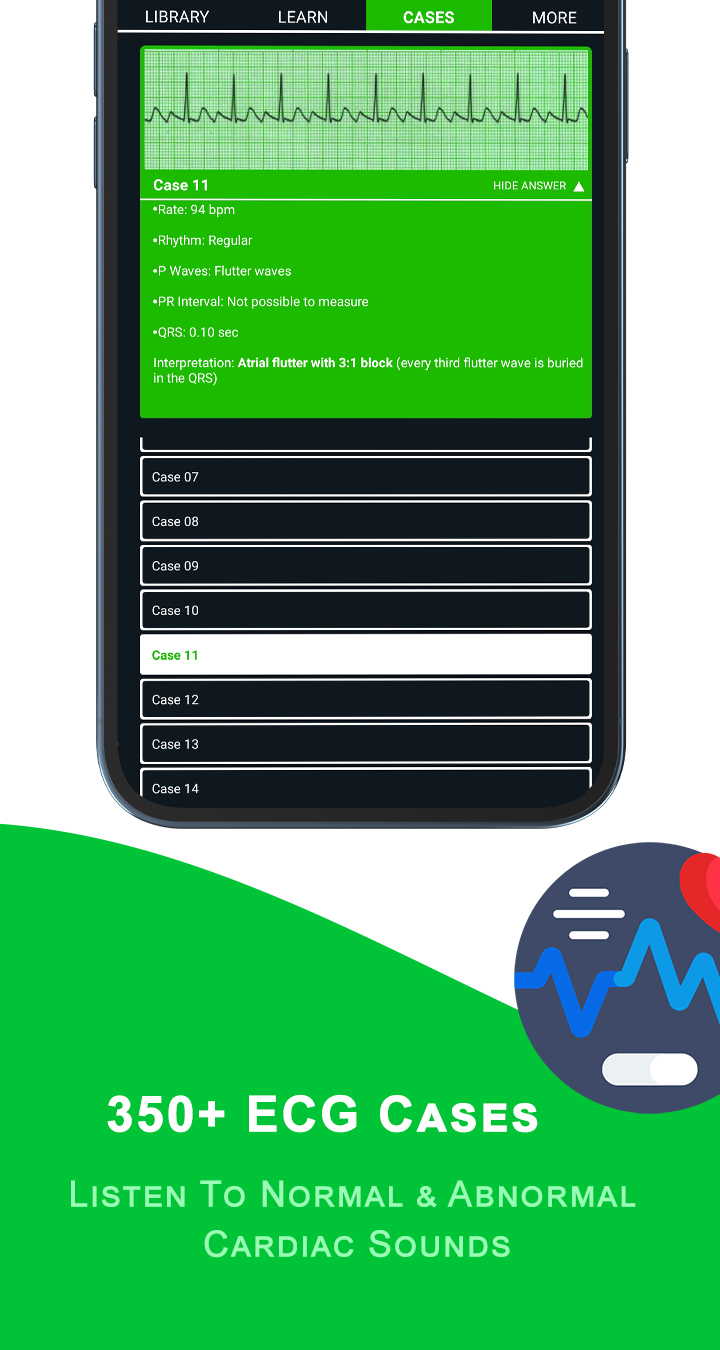 اسکرین شات 2 برنامه ECG Academy | ECG Made Easy