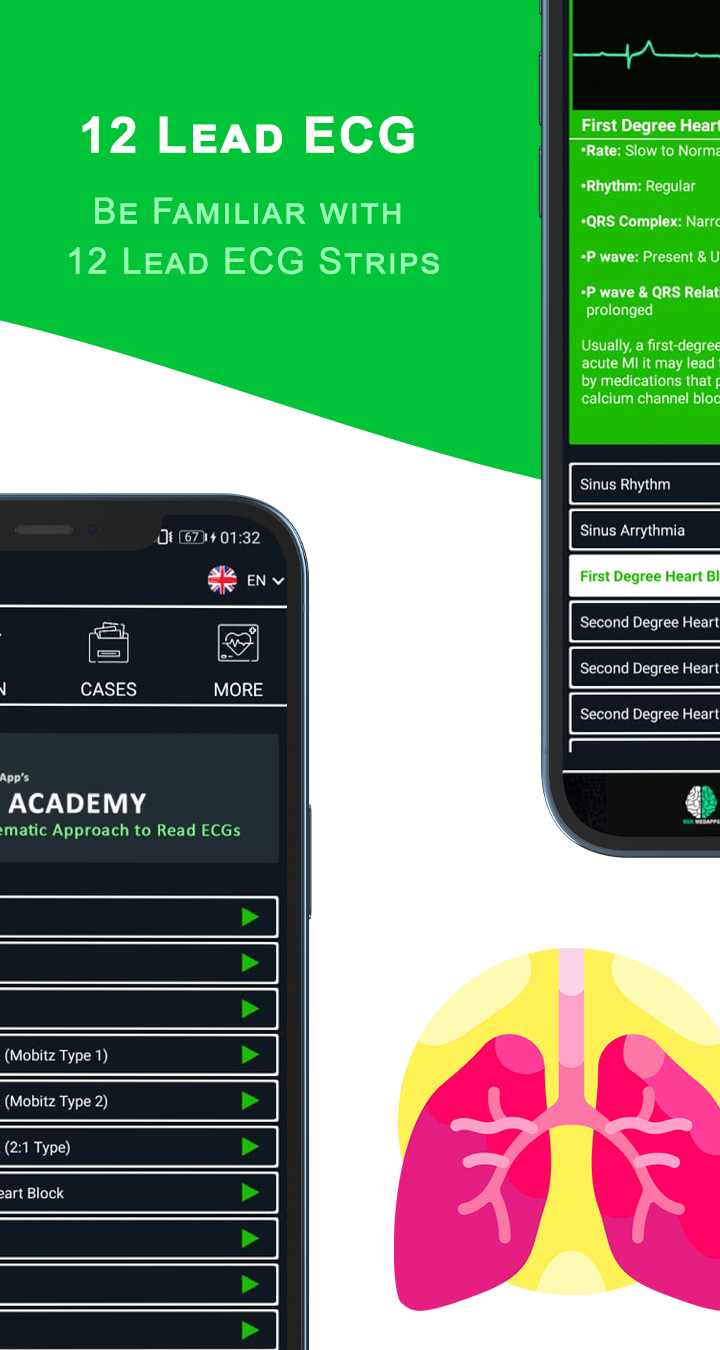 اسکرین شات 7 برنامه ECG Academy | ECG Made Easy