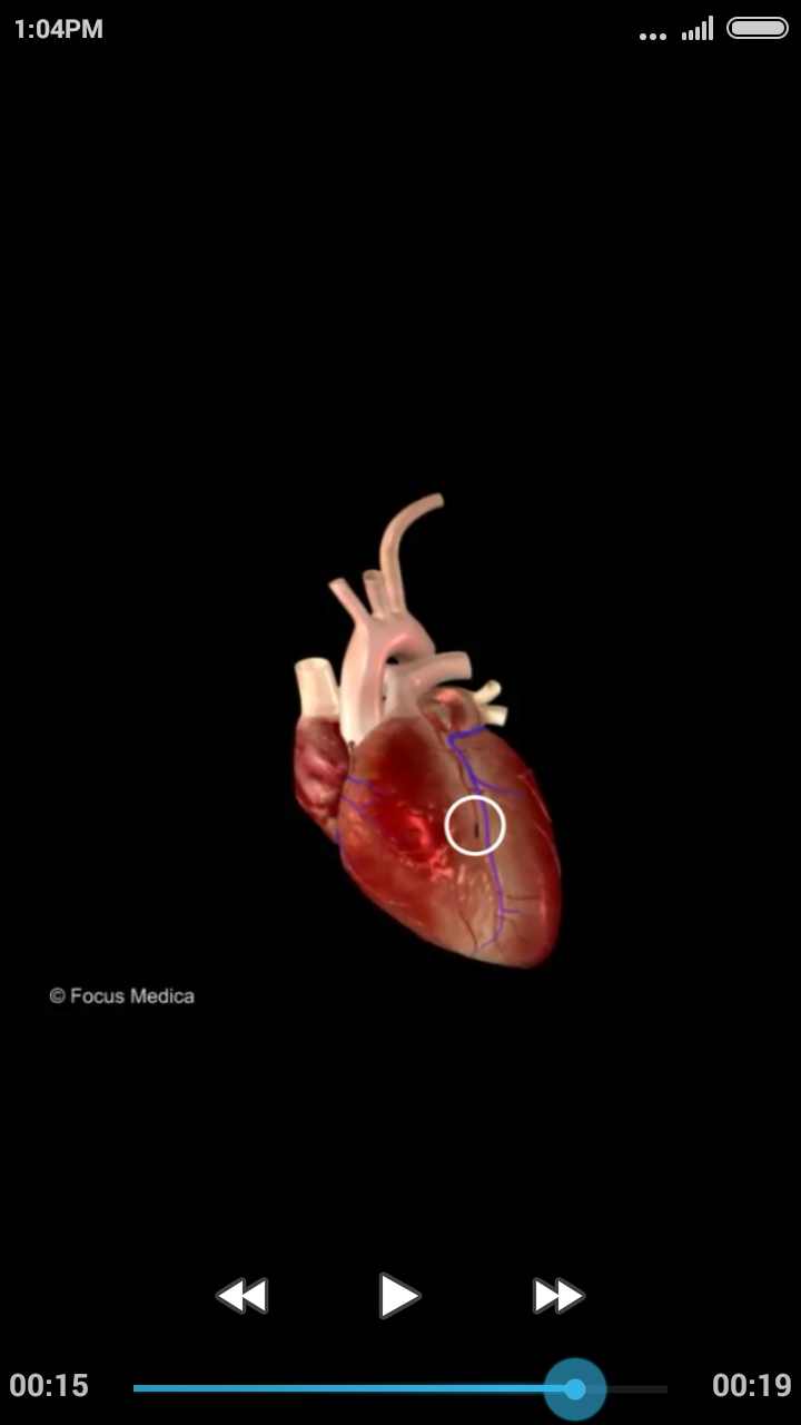اسکرین شات 4 برنامه Cardiology-Animated Dictionary
