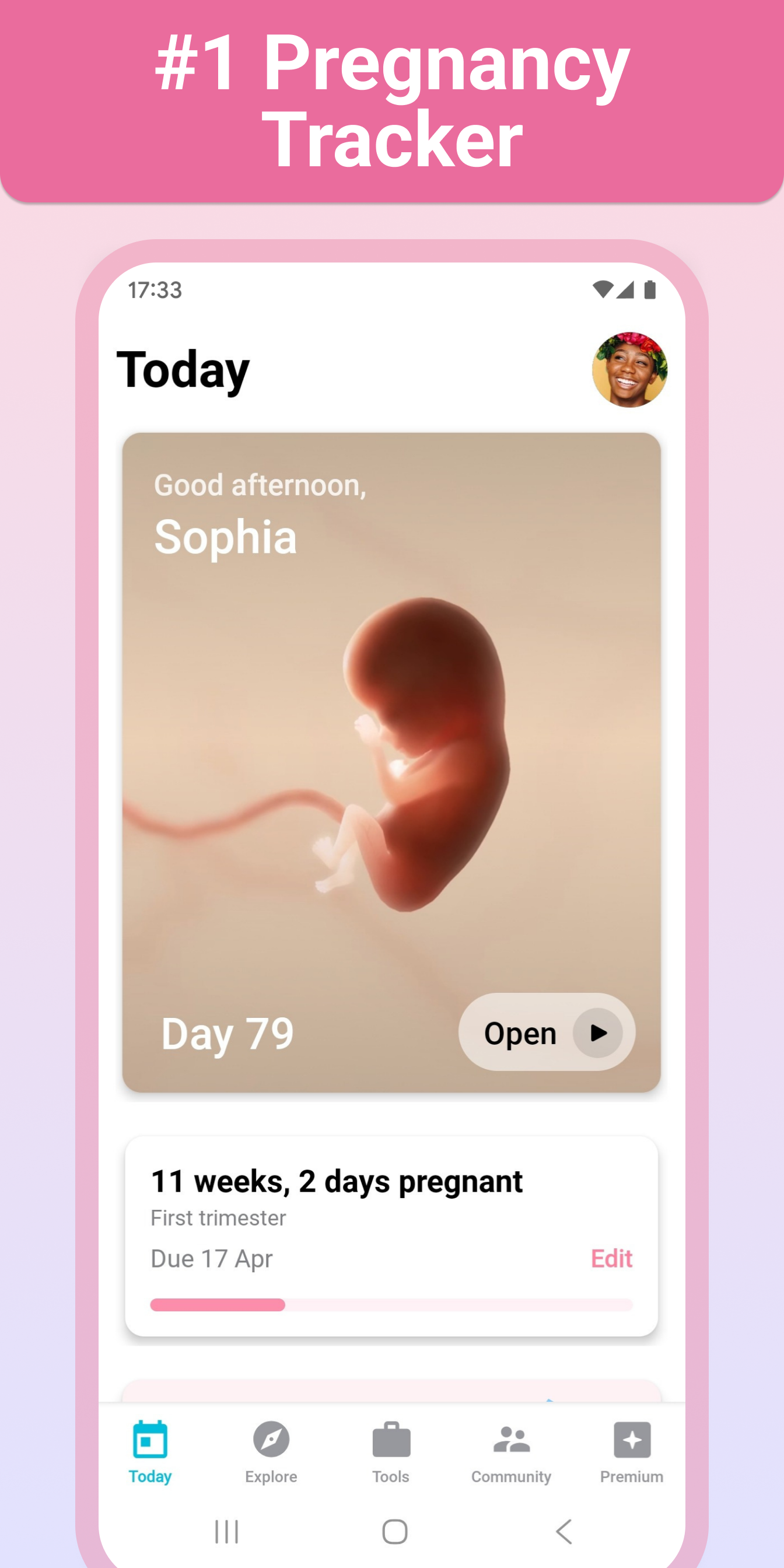 اسکرین شات 1 برنامه Pregnancy + | Tracker App