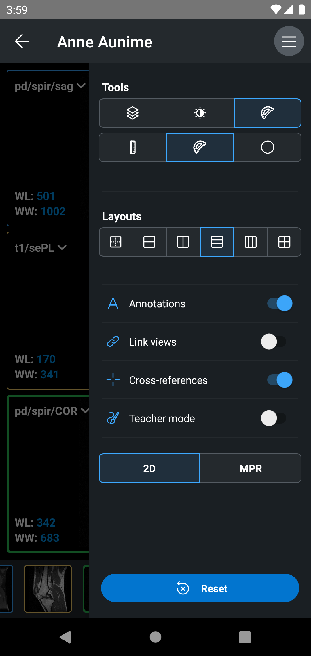 اسکرین شات 5 برنامه IDV - IMAIOS DICOM Viewer