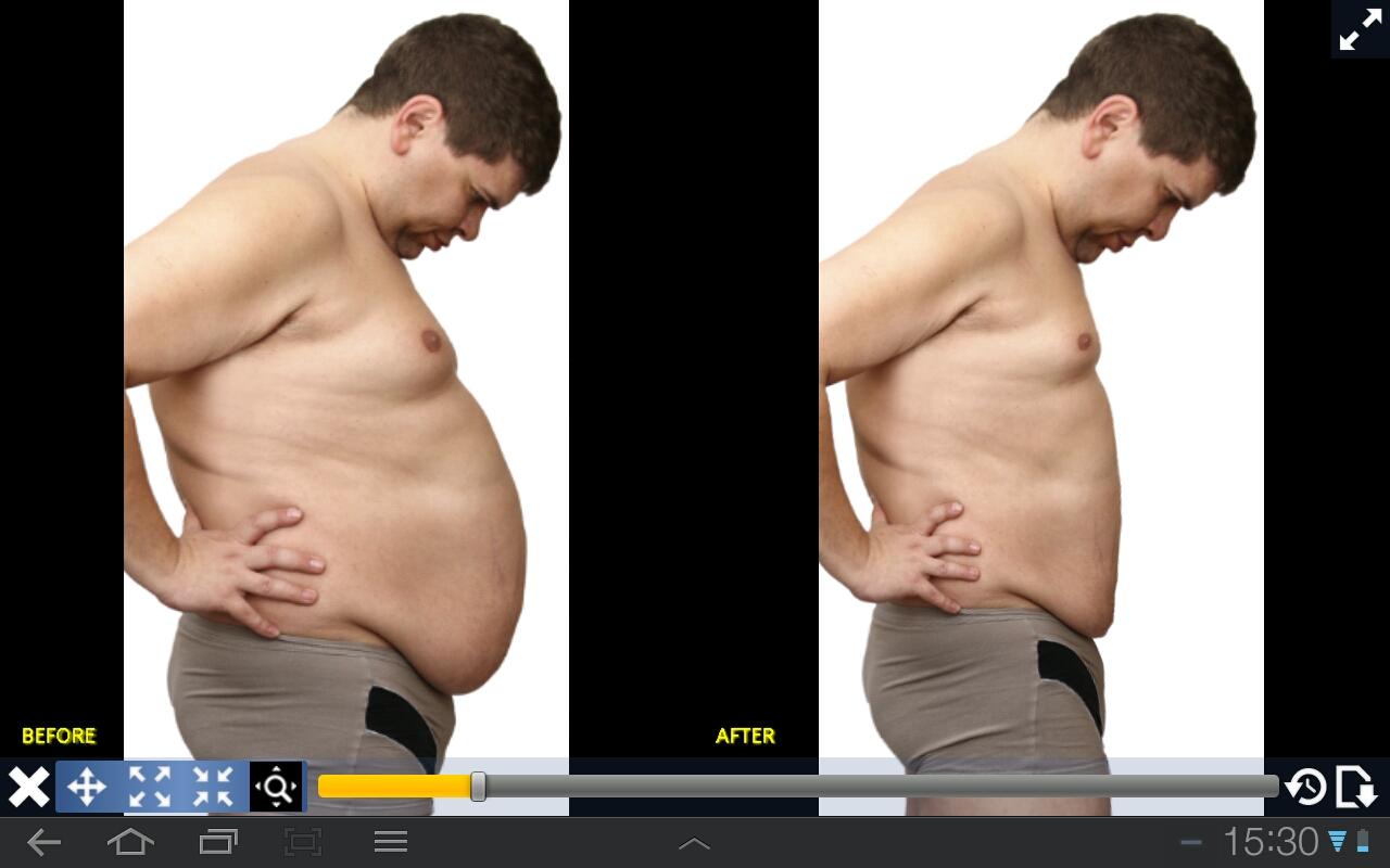 اسکرین شات 3 برنامه Plastic Surgery Simulator Lite