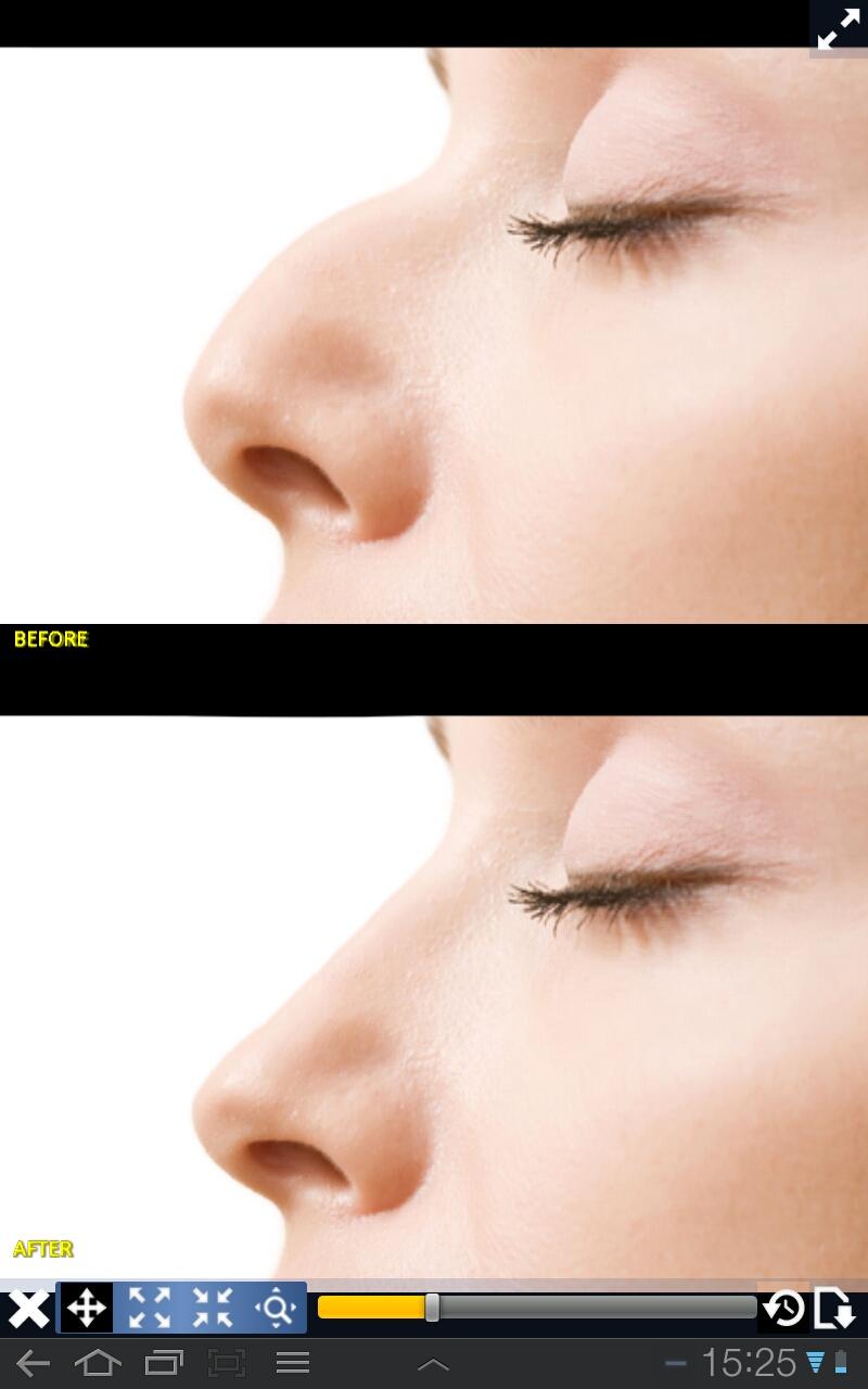 اسکرین شات 1 برنامه Plastic Surgery Simulator Lite