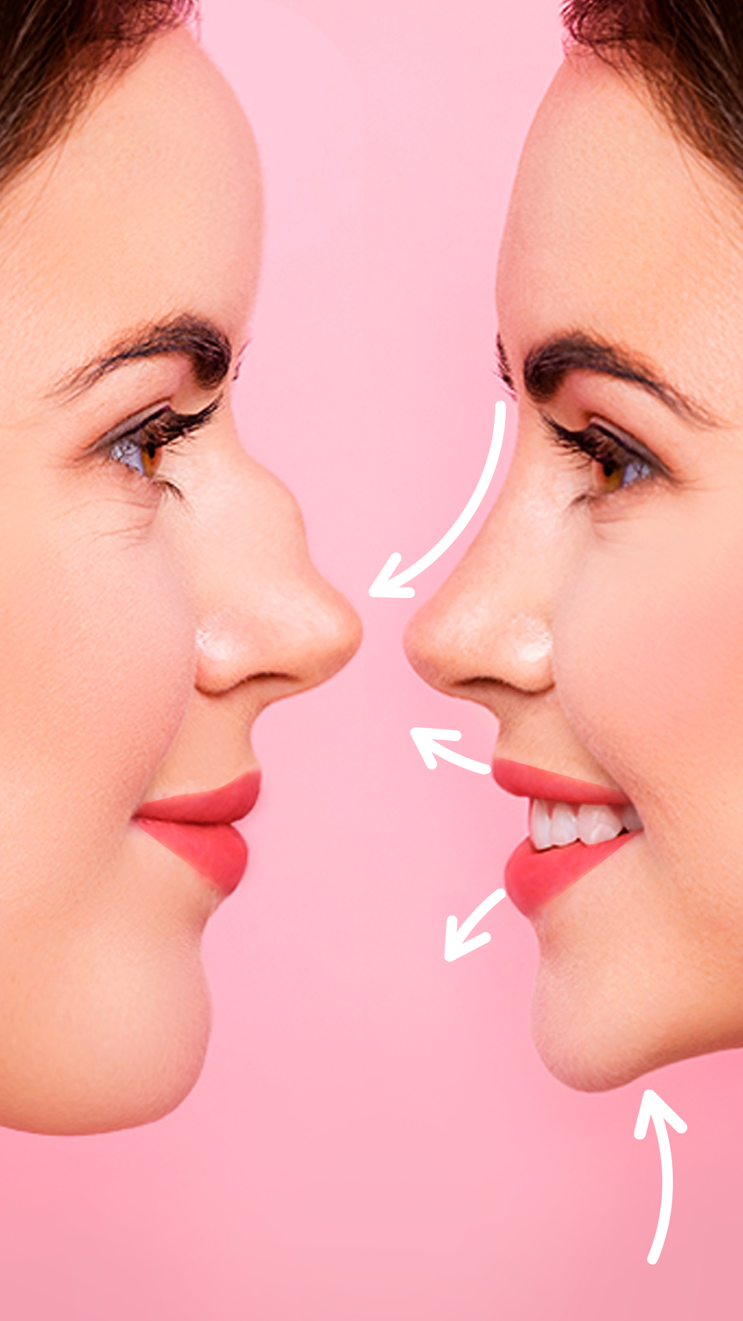 اسکرین شات 5 برنامه Rhinoplasty App: Nose Editor