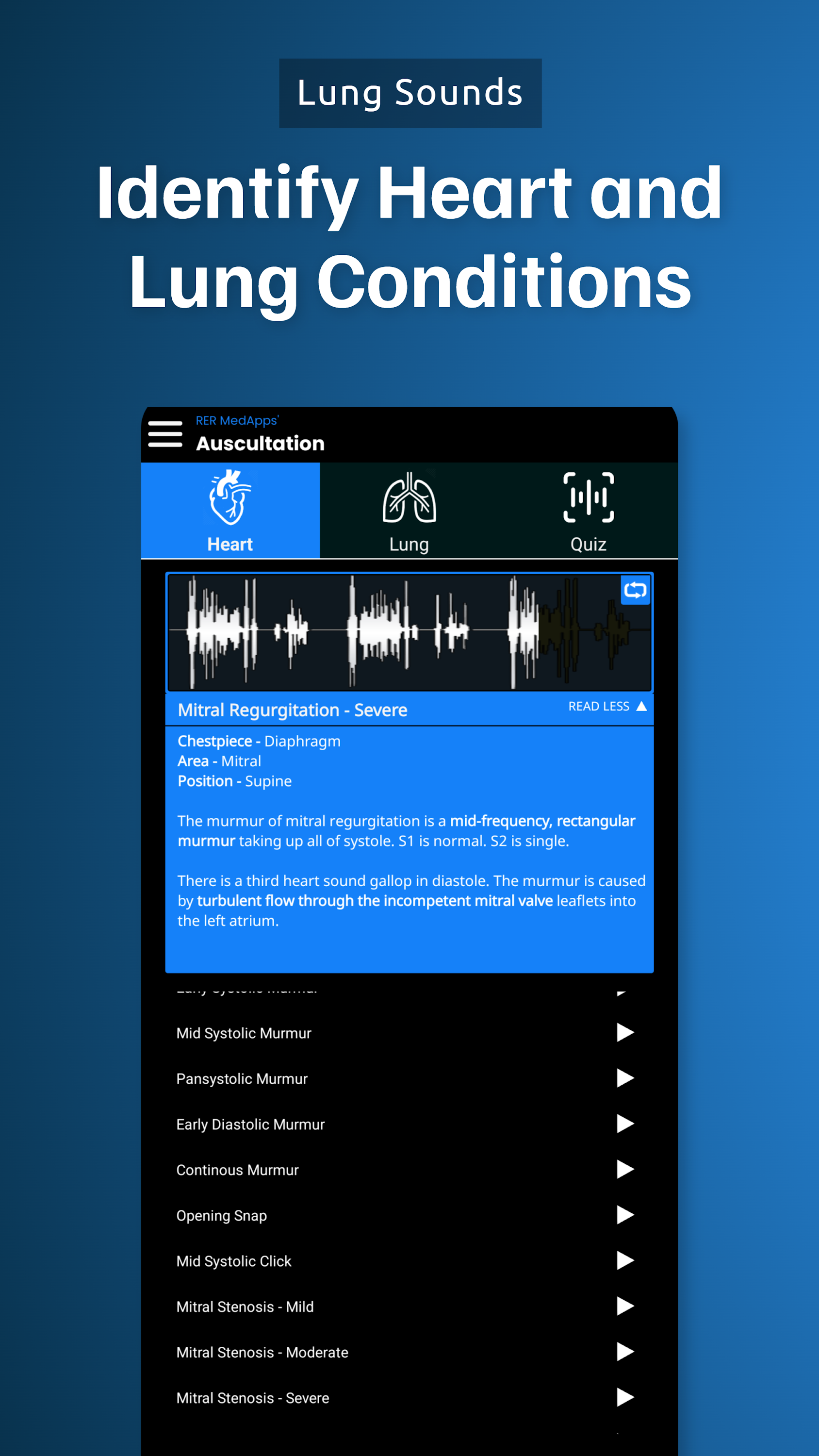 اسکرین شات 3 برنامه Auscultation | Heart Sounds