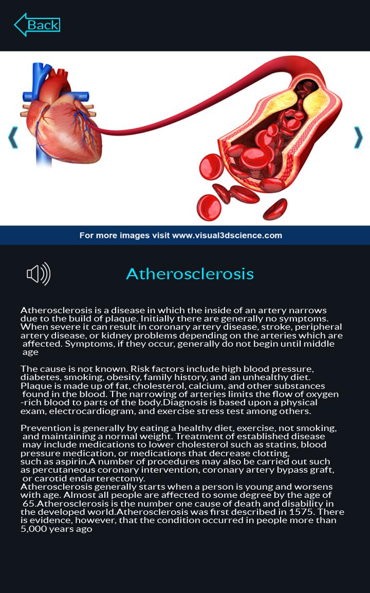 اسکرین شات 4 برنامه Circulatory System Anatomy