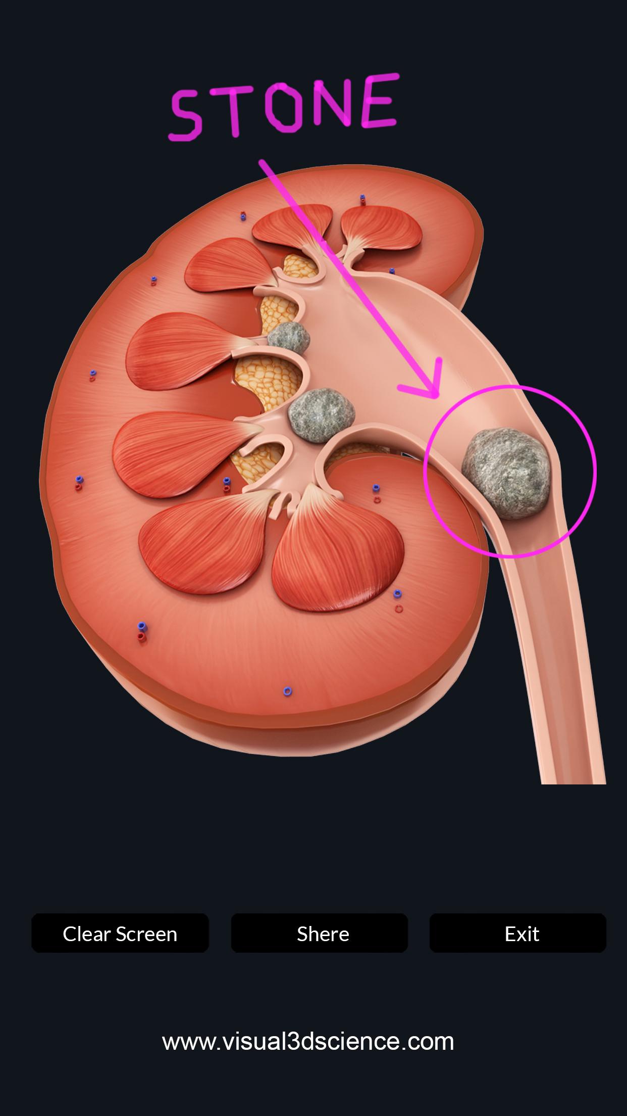اسکرین شات 7 برنامه My Urinary System