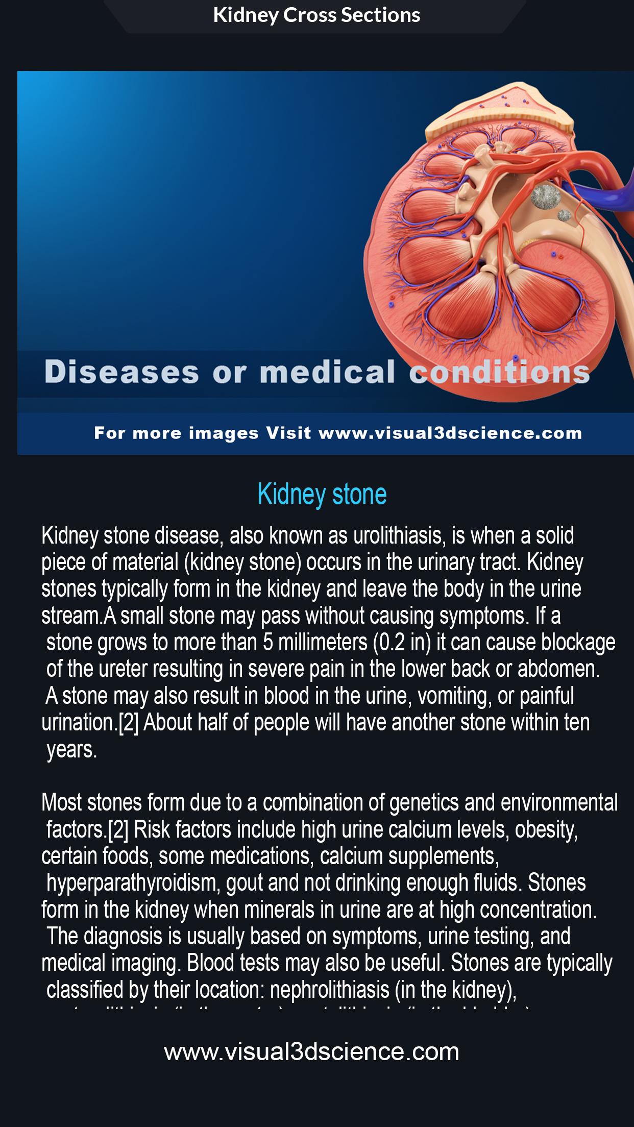 اسکرین شات 8 برنامه My Urinary System