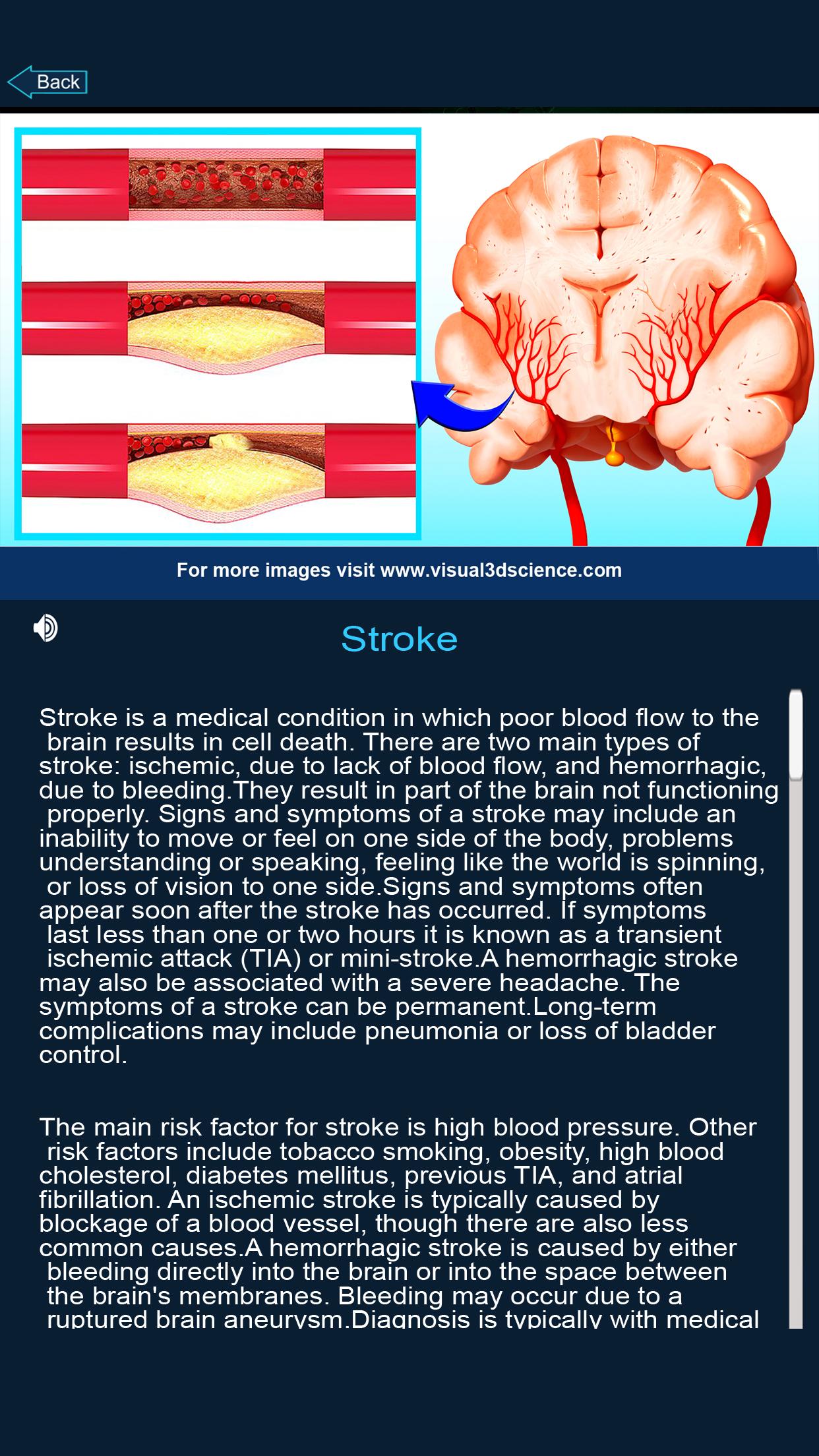 اسکرین شات 8 برنامه Brain Anatomy Pro.