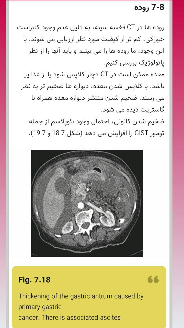 اسکرین شات 3 برنامه سی تی اسکن قفسه سینه به زبان ساده