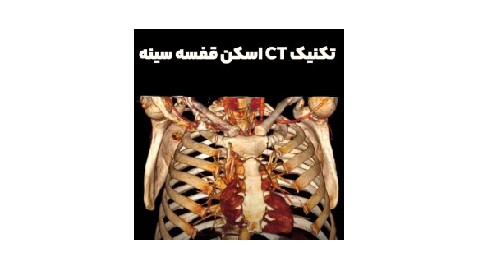 اسکرین شات 1 برنامه سی تی اسکن قفسه سینه به زبان ساده
