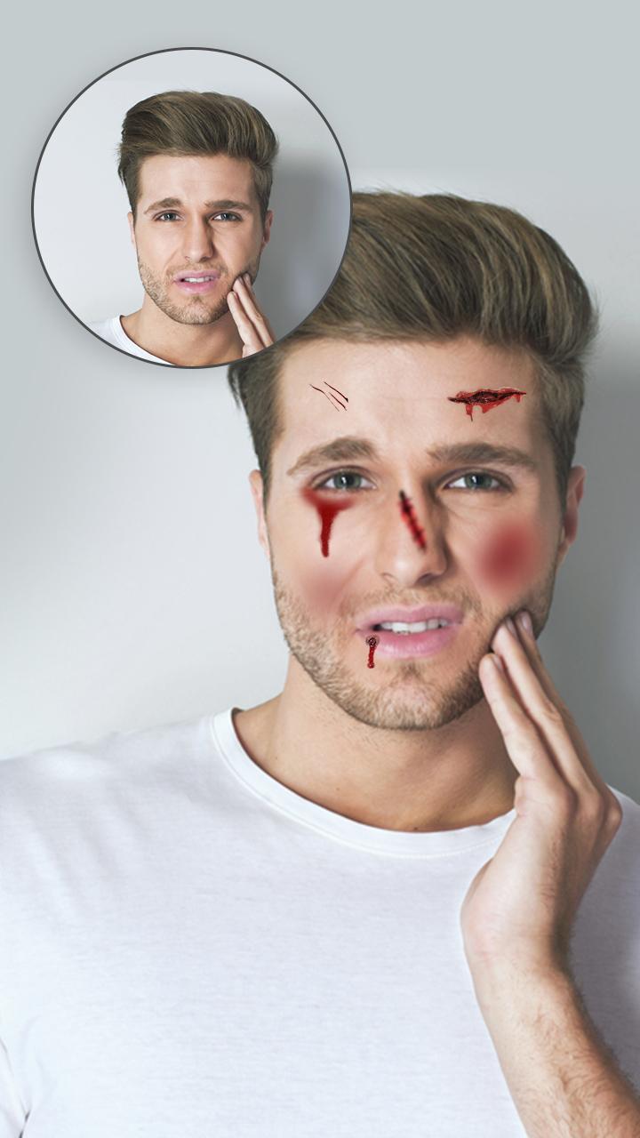 اسکرین شات 2 برنامه Injury on Face Photo Maker