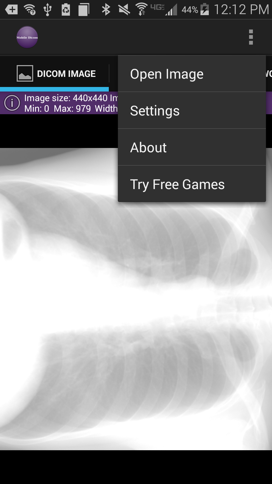 اسکرین شات 5 برنامه Mobile Dicom Viewer