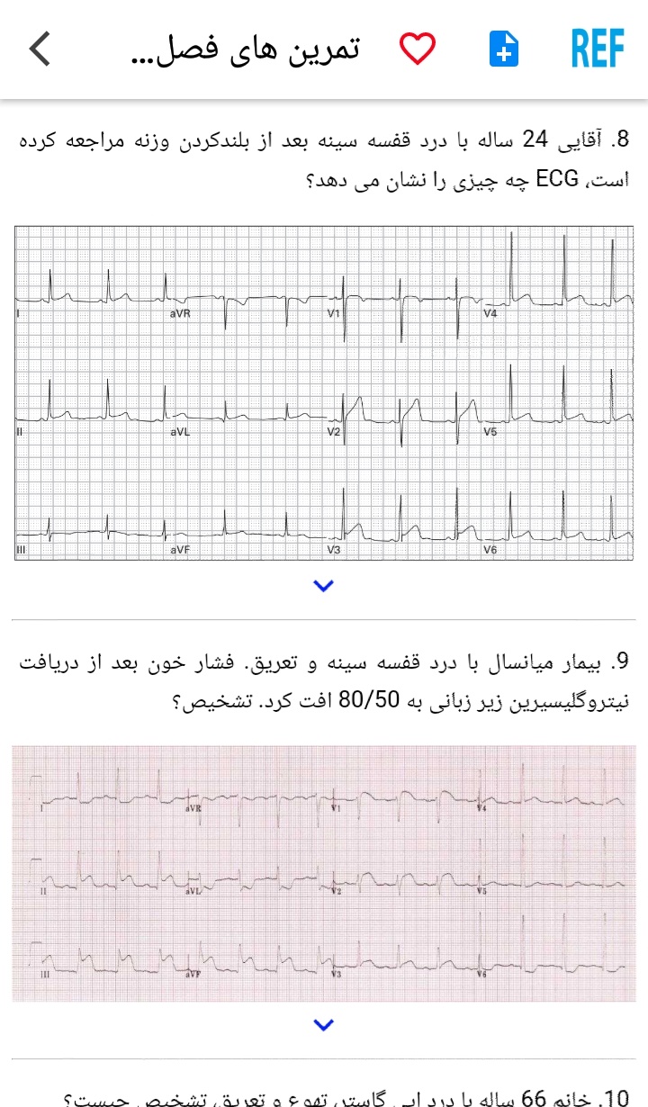 اسکرین شات برنامه مرور نوار قلب ECG review 10