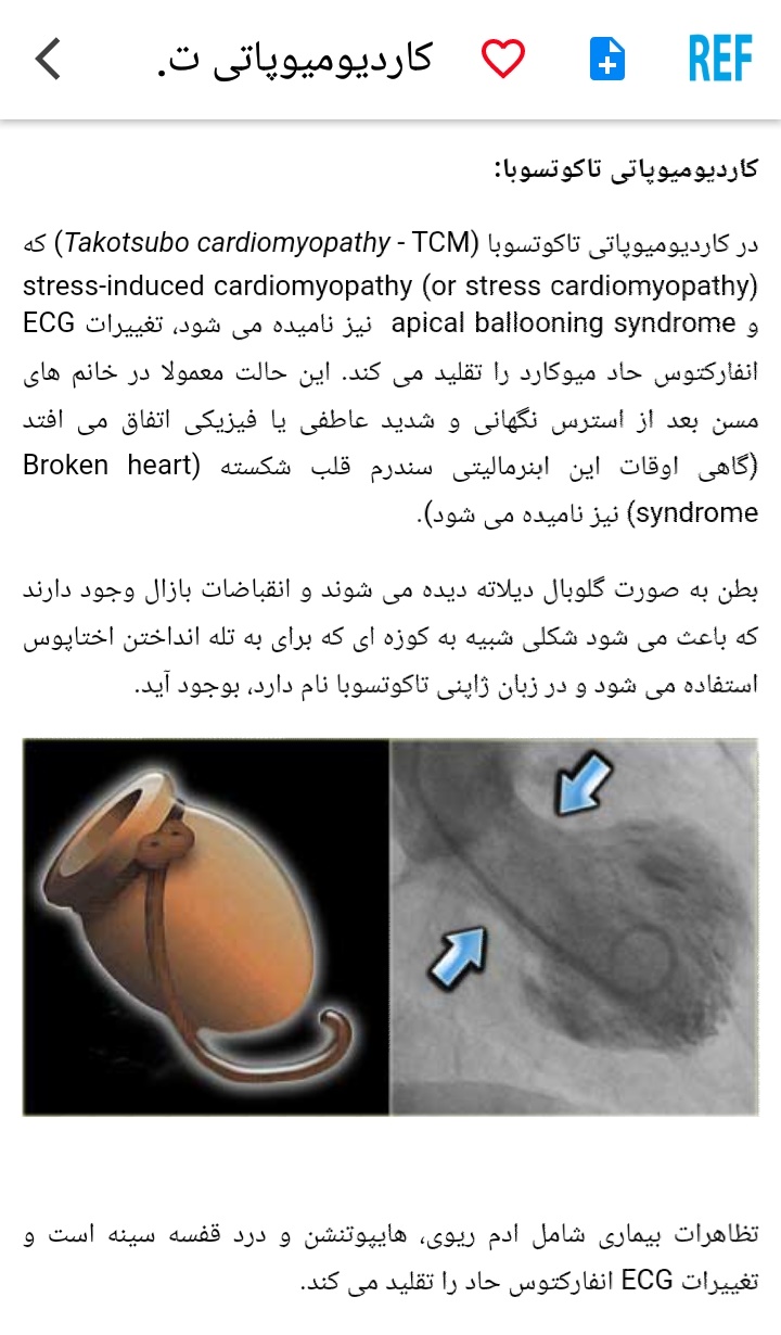 اسکرین شات برنامه مرور نوار قلب ECG review 9
