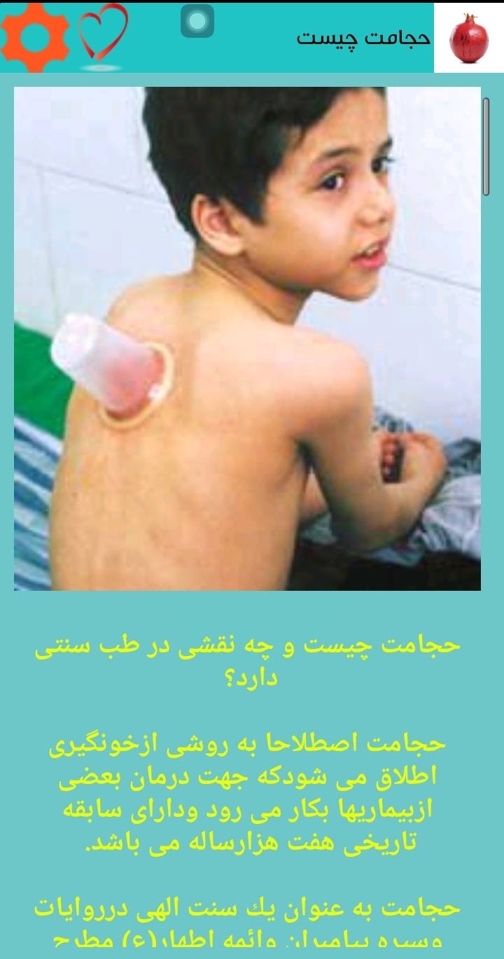 اسکرین شات 2 برنامه حجامت درمانی