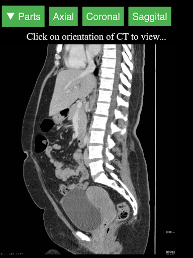 اسکرین شات 8 برنامه Radiology CT Viewer