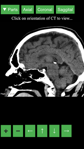 اسکرین شات 2 برنامه Radiology CT Viewer