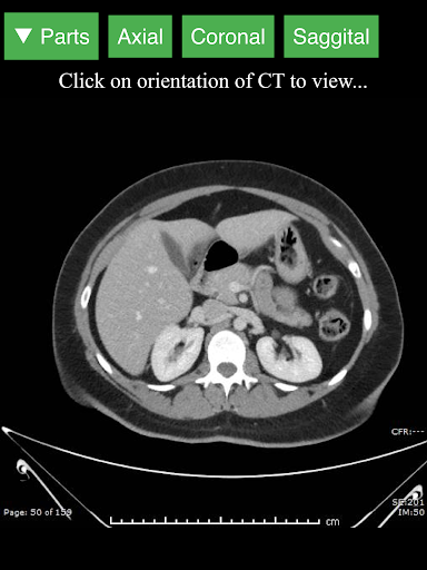 اسکرین شات 6 برنامه Radiology CT Viewer