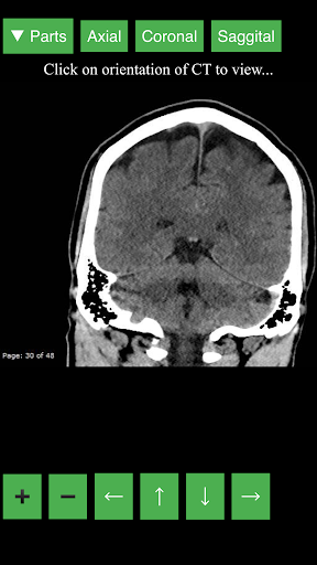 اسکرین شات 3 برنامه Radiology CT Viewer