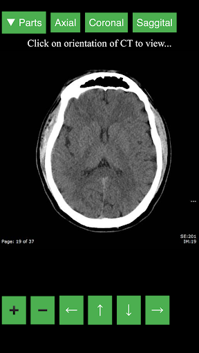 اسکرین شات 1 برنامه Radiology CT Viewer