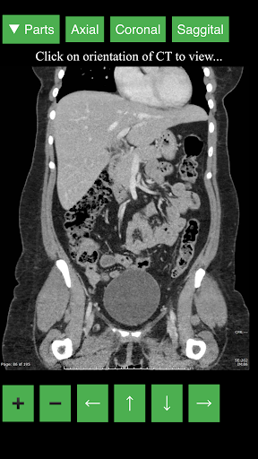 اسکرین شات 5 برنامه Radiology CT Viewer