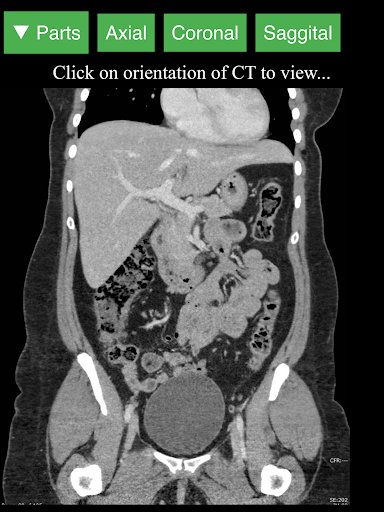 اسکرین شات 7 برنامه Radiology CT Viewer