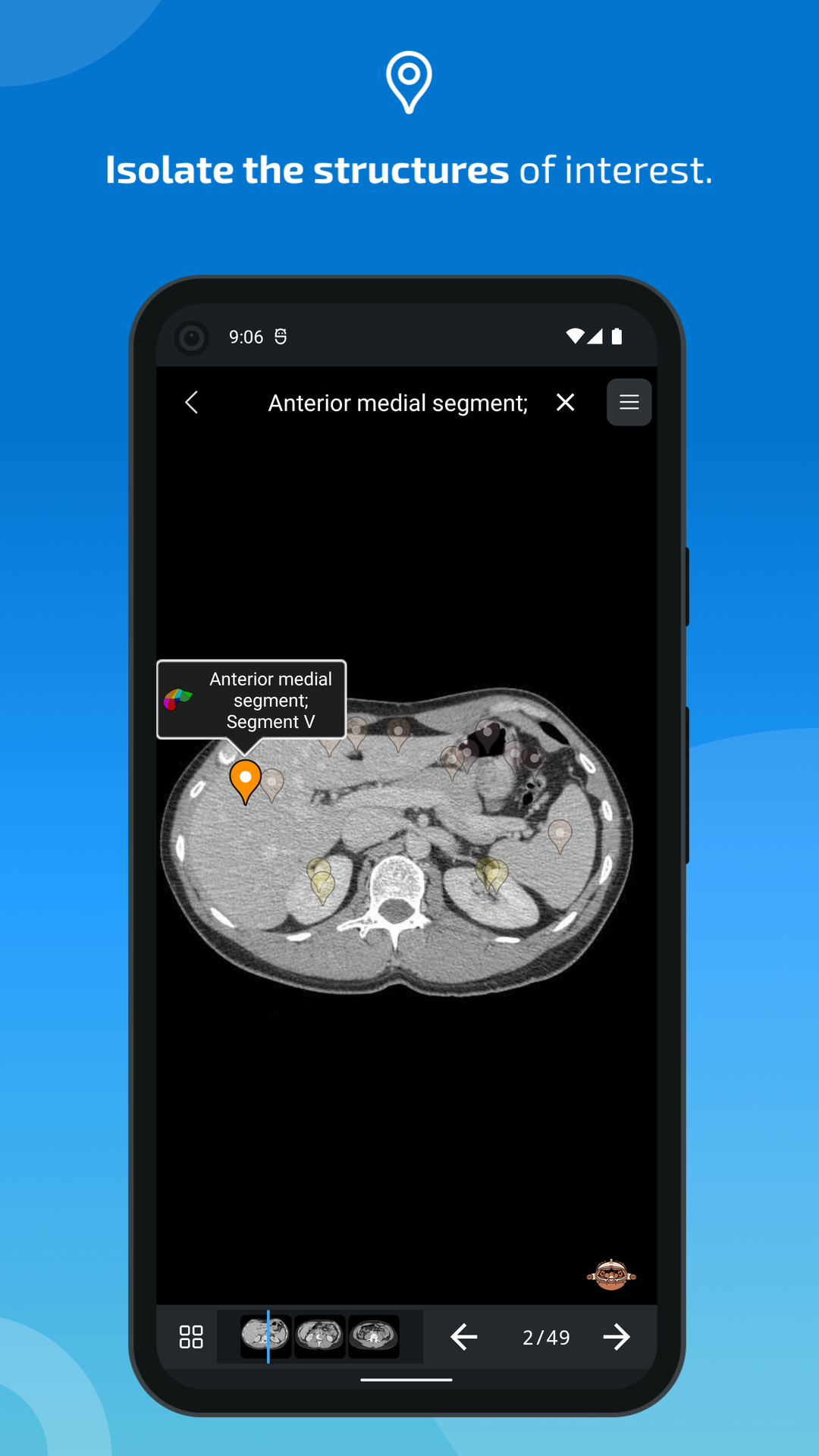 اسکرین شات 4 برنامه IMAIOS e-Anatomy