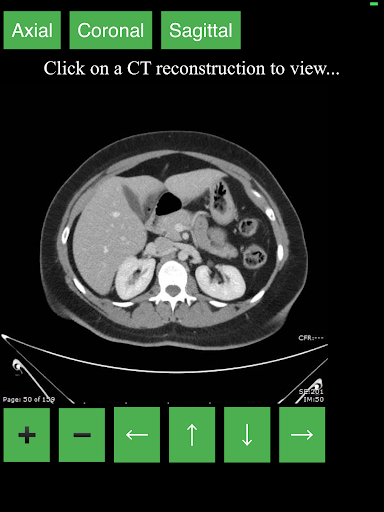 اسکرین شات 4 برنامه CT Abdomen Pelvis