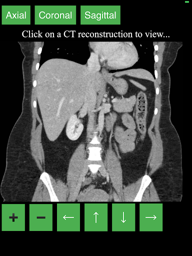 اسکرین شات 5 برنامه CT Abdomen Pelvis