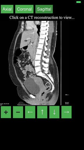 اسکرین شات 3 برنامه CT Abdomen Pelvis