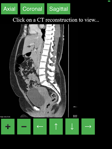 اسکرین شات 6 برنامه CT Abdomen Pelvis