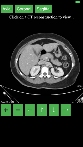 اسکرین شات 1 برنامه CT Abdomen Pelvis