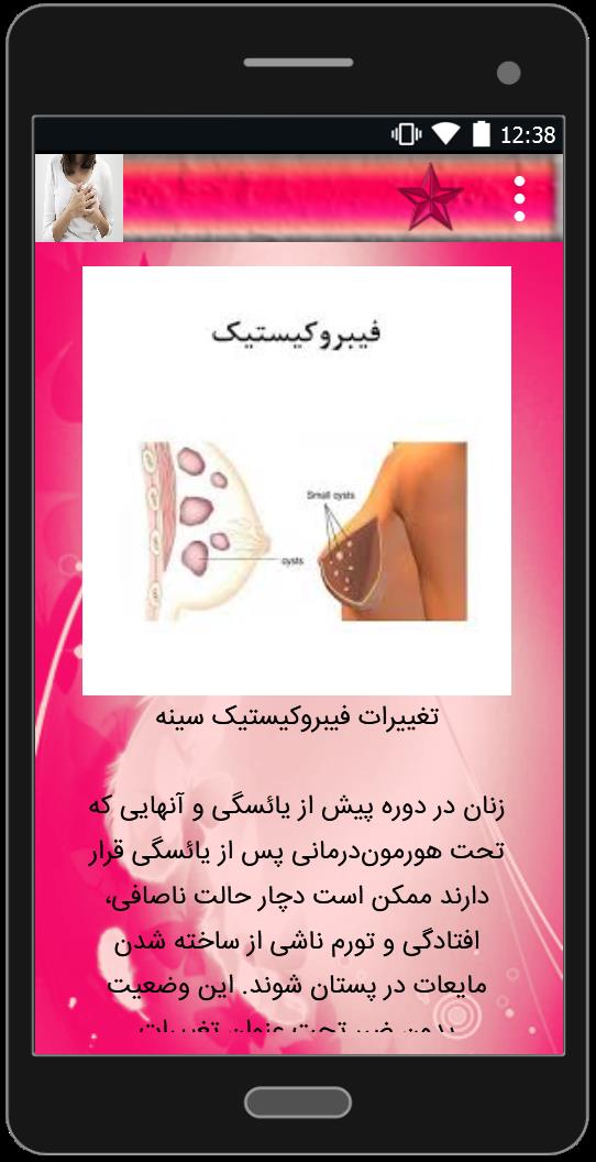 اسکرین شات 1 برنامه درد سینه در خانمها و درمان آن