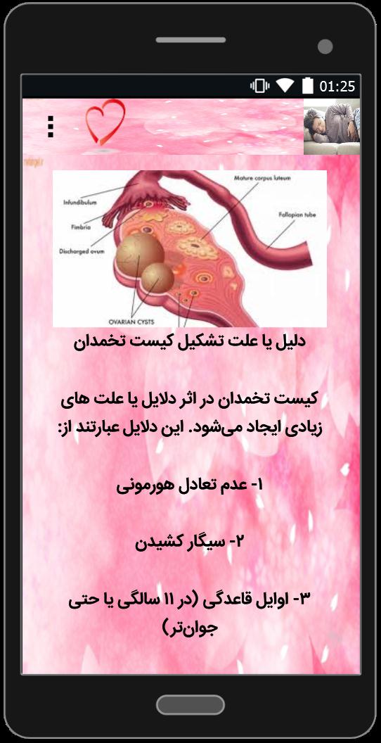 اسکرین شات 2 برنامه کیست تخمدان و درمان آن