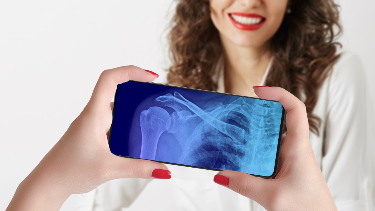 اسکرین شات 2 برنامه Xray scan filter cam