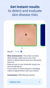 اسکرین شات برنامه AI Dermatologist: Skin Scanner 4