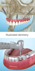 اسکرین شات 6 برنامه Dental 3D Illustrations