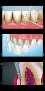 اسکرین شات برنامه Dental 3D Illustrations for patient education 6