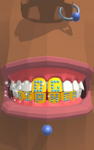 اسکرین شات بازی Dentist Bling 5