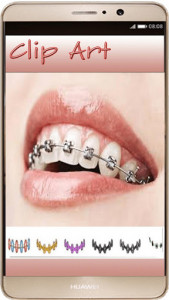 اسکرین شات برنامه Braces Photo Editor - Braces For Your Teeth 1